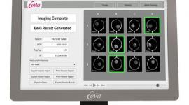 Представлена новая тестовая система Eeva, призванная улучшить результаты ЭКО