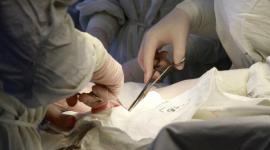 Беременной женщине провели операцию по удалению опухоли величиной с матку