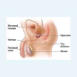 Опухоли предстательной железы