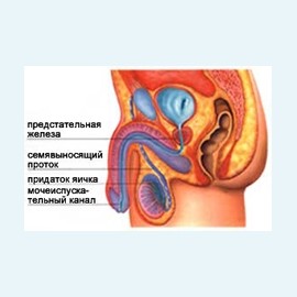 Непроходимость семявыносящих путей