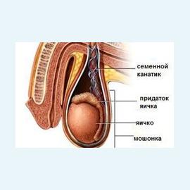Отсутствие семявыводящего протока
