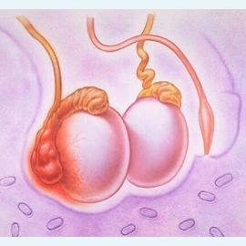 Воспаление органов мошонки у мальчиков и мужчин