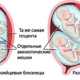 Родила 2 раза за 2 дня