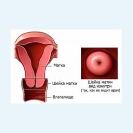 Шейка матки – выворот, воспаление, разрывы