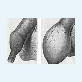 Половой член и его патологии