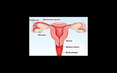 Клиника внематочной беременности