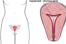 Тонкий эндометрий матки: причины, последствия и лечение