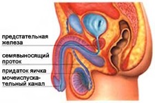 Непроходимость семявыносящих путей