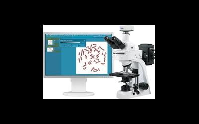 Кариотипирование - диагностика хромосомных нарушений
