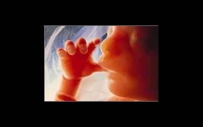 ЭКО и редукция эмбрионов