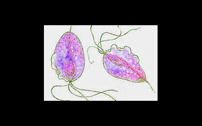 Трихомониаз: как диагностировать и лечить? 