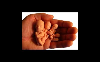 Причины и профилактика абортов