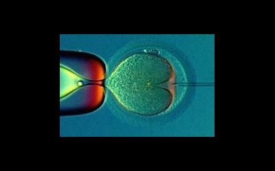 Вспомогательные репродуктивные технологии (ВРТ)