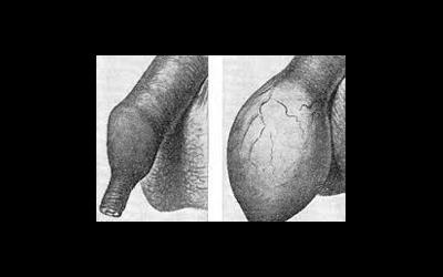 Половой член и его патологии