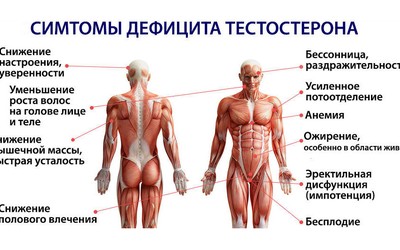 Признаки низкого уровня тестостерона у мужчин